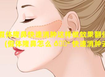 假体隆鼻快速消肿这样做效果翻倍(假体隆鼻怎么 💮 快速消肿去淤青)